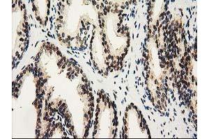 Image no. 5 for anti-Nonhomologous End-Joining Factor 1 (NHEJ1) antibody (ABIN1499729) (NHEJ1 抗体)