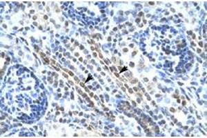Immunohistochemical staining (Formalin-fixed paraffin-embedded sections) of human kidney with ANKRD11 polyclonal antibody  at 4-8 ug/mL working concentration. (ANKRD11 抗体  (N-Term))