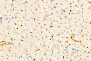 Immunohistochemistry analysis of paraffin-embedded mouse heart using,DMPK (ABIN7073790) at dilution of 1: 2000 (DMPK 抗体)