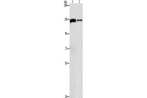Western Blotting (WB) image for anti-ATP Citrate Lyase (ACLY) antibody (ABIN2429586) (ACLY 抗体)