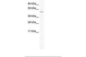 Image no. 1 for anti-Ceramide Synthase 4 (CERS4) (AA 49-98) antibody (ABIN202416) (LASS4 抗体  (AA 49-98))