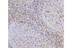 IHC analysis of CD43 using anti-CD43 antibody (ABIN7601042). (CD43 抗体  (AA 272-400))