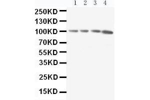 Anti-RIAM antibody, Western blotting Lane 1: Rat Thymus Tissue Lysate Lane 2: Rat Spleen Tissue Lysate Lane 3: Rat RAJI Tissue Lysate Lane 4: HL-60 Cell Lysate (Amyloid beta (A4) Precursor Protein-Binding, Family B, Member 1 Interacting Protein (APBB1IP) (AA 647-666), (C-Term) 抗体)