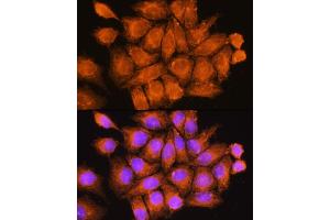 Immunofluorescence analysis of HeLa cells using CF Rabbit pAb (ABIN7266431) at dilution of 1:100. (CCDC11 抗体  (AA 1-300))