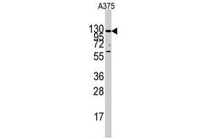 Western blot analysis of IDE polyclonal antibody  in A-375 cell line lysates (35 ug/lane). (IDE 抗体  (Internal Region))