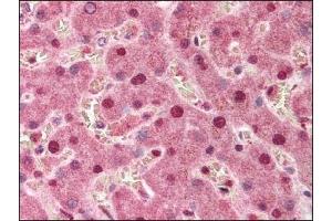 Image no. 1 for anti-Protein Phosphatase 1, Regulatory Subunit 13 Like (PPP1R13L) (Isoform 1) antibody (ABIN303133)