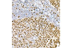 Immunohistochemistry (IHC) image for anti-Proliferating Cell Nuclear Antigen (PCNA) antibody (ABIN6139020)