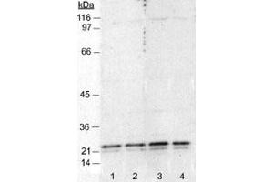 Western blot analysis of CAV1 in NIH/3T3 cell lysates (50 ug) using CAV1 monoclonal antibody, clone 7C8 .