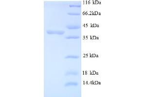SDS-PAGE (SDS) image for Mindbomb E3 Ubiquitin Protein Ligase 1 (MIB1) (AA 5-332), (partial) protein (His tag) (ABIN5712848)