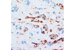 Image no. 1 for anti-Junction Plakoglobin (JUP) (N-Term) antibody (ABIN1494121) (JUP 抗体  (N-Term))
