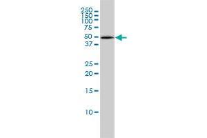 Western Blotting (WB) image for anti-Proteasome (Prosome, Macropain) 26S Subunit, ATPase, 4 (PSMC4) (AA 1-418) antibody (ABIN562488)