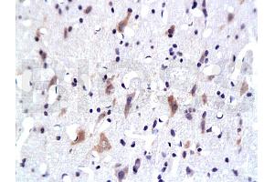 Formalin-fixed and paraffin embedded: rat brain tissue labeled with Anti-PKB Polyclonal Antibody, Unconjugated 1:200 followed by conjugation to the secondary antibody and DAB staining (AKT1/3 (AA 401-479) 抗体)