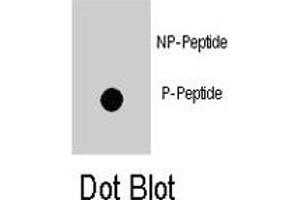 Dot blot analysis of ZBTB16 (phospho Y334) polyclonal antibody  on nitrocellulose membrane. (ZBTB16 抗体  (pTyr334))