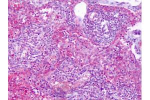 Anti-S1PR4 / EDG6 antibody IHC of human lymph node. (S1PR4 抗体  (Cytoplasmic Domain))