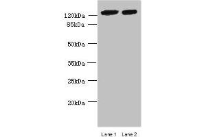 Western blot All lanes: MCM9 antibody at 0. (MCM9 抗体  (AA 1-391))