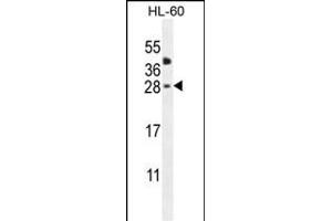 CLEC2A Antibody (Center) (ABIN655012 and ABIN2844646) western blot analysis in HL-60 cell line lysates (35 μg/lane). (CLEC2A 抗体  (AA 79-107))