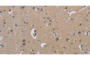 Immunohistochemistry of paraffin-embedded Human brain using HSD3B1 Polyclonal Antibody at dilution of 1:40 (HSD3B1 抗体)