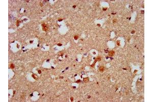 IHC image of ABIN7146458 diluted at 1:500 and staining in paraffin-embedded human brain tissue performed on a Leica BondTM system. (Calcyphosine 2 抗体  (AA 191-274))