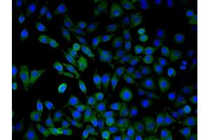 SMMC7721 cells were stained with ARMC3 Polyclonal Antibody, Unconjugated  at 1:50 in PBS and incubated for one hour at room temperature, followed by secondary antibody incubation, DAPI staining of the nuclei and detection. (ARMC3 抗体  (AA 752-840))