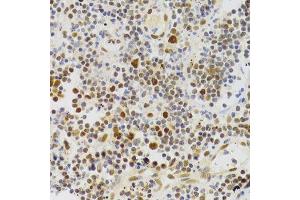 Immunohistochemistry (Paraffin-embedded Sections) (IHC (p)) image for anti-Nuclear Autoantigenic Sperm Protein (Histone-Binding) (NASP) (AA 180-449) antibody (ABIN6144374)