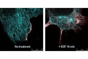 Immunofluorescence (IF) image for anti-V-Akt Murine Thymoma Viral Oncogene Homolog 1 (AKT1) (Ser473) antibody (ABIN400784) (AKT1 抗体  (Ser473))