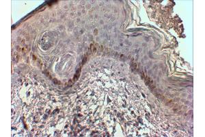 ABIN768626 (2µg/ml) staining of paraffin embedded Human Skin. (CMA1 抗体  (Internal Region))