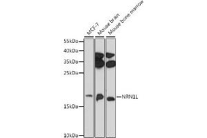Western blot analysis of extracts of various cell lines, using NRN1L antibody (ABIN7268861) at 1:1000 dilution. (Neuritin 1-Like 抗体)