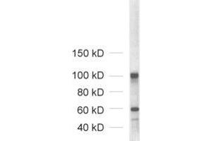 Western Blotting (WB) image for anti-Neuroligin 1/2/3/4 (NLGN1/2/3/4) (AA 1-695) antibody (ABIN1742285) (Neuroligin 1/2/3/4 抗体  (AA 1-695))