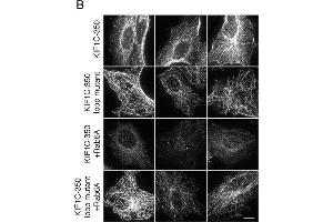 Immunofluorescence (Cultured Cells) (IF (cc)) image for anti-RAB6A, Member RAS Oncogene Family (RAB6A) antibody (ABIN2856770)