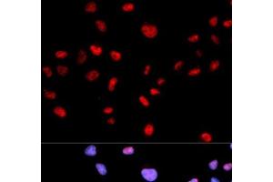 Immunofluorescence analysis of MCF-7 cells using Phospho-CDK1(T161) Polyclonal Antibody (CDK1 抗体  (pThr161))