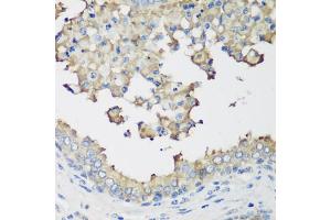 Immunohistochemistry of paraffin-embedded human prostate using NEDD4L antibody. (NEDD4-2 抗体)
