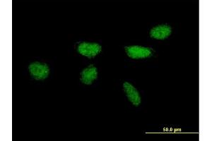 Immunofluorescence of purified MaxPab antibody to XPA on HeLa cell. (XPA 抗体  (AA 1-273))