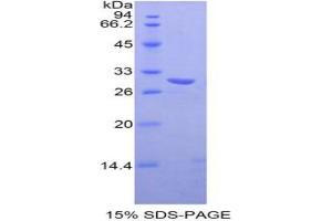 SDS-PAGE analysis of Mouse TXK Tyrosine Kinase Protein. (TXK 蛋白)