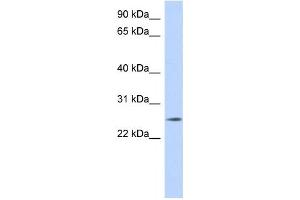 Western Blotting (WB) image for anti-Na+/K+ Transporting ATPase Interacting 4 (NKAIN4) antibody (ABIN2459631) (NKAIN4 抗体)