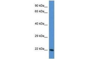 Transgelin 3 antibody  (AA 55-104)