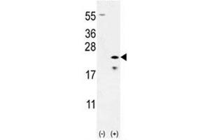 Western blot analysis of Bax antibody and 293 cell lysate (2 ug/lane) either nontransfected (Lane 1) or transiently transfected (2) with the Bax gene. (BAX 抗体  (AA 41-76))