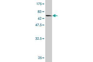 Western Blot detection against Immunogen (65. (HMBS 抗体  (AA 1-361))