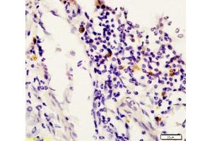 Immunohistochemistry (Paraffin-embedded Sections) (IHC (p)) image for anti-Signal Transducer and Activator of Transcription 6, Interleukin-4 Induced (STAT6) (AA 601-700) antibody (ABIN738291)