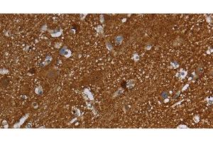 Immunohistochemistry of paraffin-embedded Human brain using SNCG Polyclonal Antibody at dilution of 1:60 (SNCG 抗体)