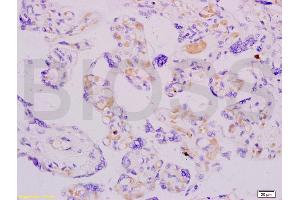 Formalin-fixed and paraffin embedded human placenta labeled with Anti-ADFP Polyclonal Antibody, Unconjugated (ABIN738606) at 1:200 followed by conjugation to the secondary antibody and DAB staining. (ADRP 抗体  (AA 31-130))