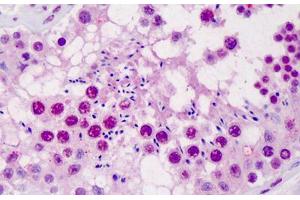 Human Testis: Formalin-Fixed, Paraffin-Embedded (FFPE) (SCML1 抗体  (AA 3-101))