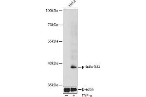 Western blot analysis of extracts of HeLa cells, using Phospho-IκBα-S32 antibody (ABIN6135267, ABIN6136154, ABIN6136155 and ABIN6225645) at 1:1000 dilution. (NFKBIA 抗体  (pSer32))