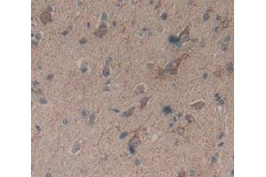 Used in DAB staining on fromalin fixed paraffin- embedded Kidney tissue (Basonuclin 1 抗体  (AA 43-246))