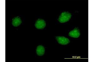 Immunofluorescence of purified MaxPab antibody to CREB3L1 on HeLa cell. (CREB3L1 抗体  (AA 1-519))