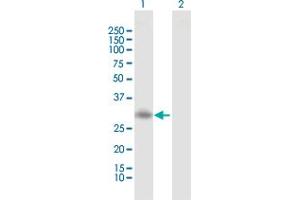 Western Blot analysis of RGS20 expression in transfected 293T cell line by RGS20 MaxPab polyclonal antibody. (RGS20 抗体  (AA 1-241))
