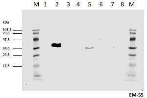 Cell lyzates of HEK293T/17 cells transiently transfected with expression vectors harboring genes for mCD3zeta wild type and six different mCD3zeta mutants, where particular ITAM tyrosines were substituted with phenylalanines, were prepared. (CD247 抗体  (pTyr111, pTyr123))