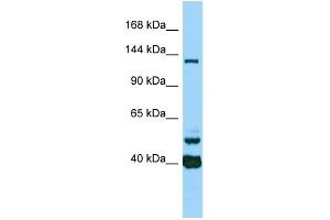 Host: Rabbit Target Name: CAMSAP3 Sample Type: ACHN Whole Cell lysates Antibody Dilution: 1.