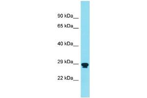 Host: Rabbit Target Name: RNF151 Sample Type: THP-1 Whole Cell lysates Antibody Dilution: 1. (RNF151 抗体  (Middle Region))