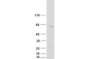 Western Blotting (WB) image for Deafness, Autosomal Dominant 5 (DFNA5) (Transcript Variant 1) protein (Myc-DYKDDDDK Tag) (ABIN2719436)