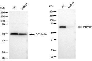 Western blotting analysis using PTPN11 antibody (ABIN7800040).